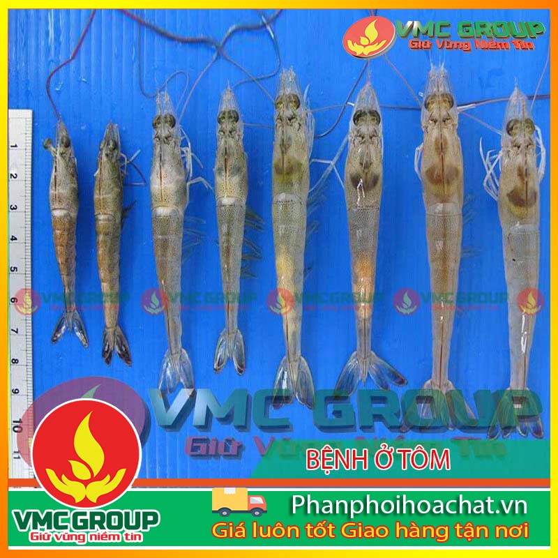 benh-do-vi-bao-tu-trung-microsporidian-pphcvm benh-do-vi-bao-tu-trung-microsporidian-pphcvm