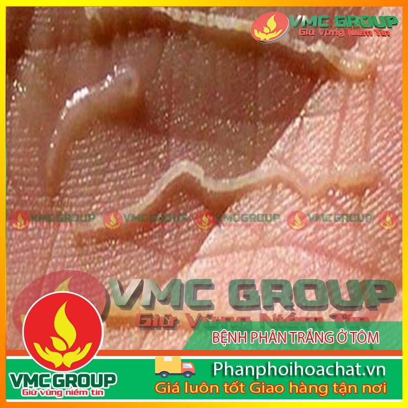 benh-phan-trang-o-tom-pphcvm benh-phan-trang-o-tom-pphcvm