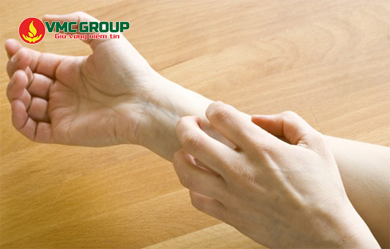 SLES có thể gây kích ứng da